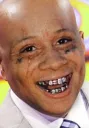 bald trippie