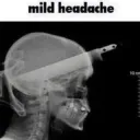 just a mild headache