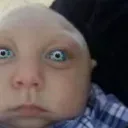 babystare
