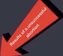 Failed Abortion