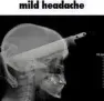 Mild Headache