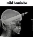 headace