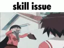 skill issue 