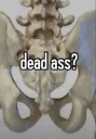 Dead Ass?