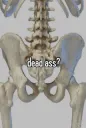 dead ass