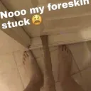 foreskin