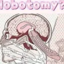 Lobotomy 