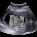 ultrasound