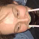 bigassfuckingforehead